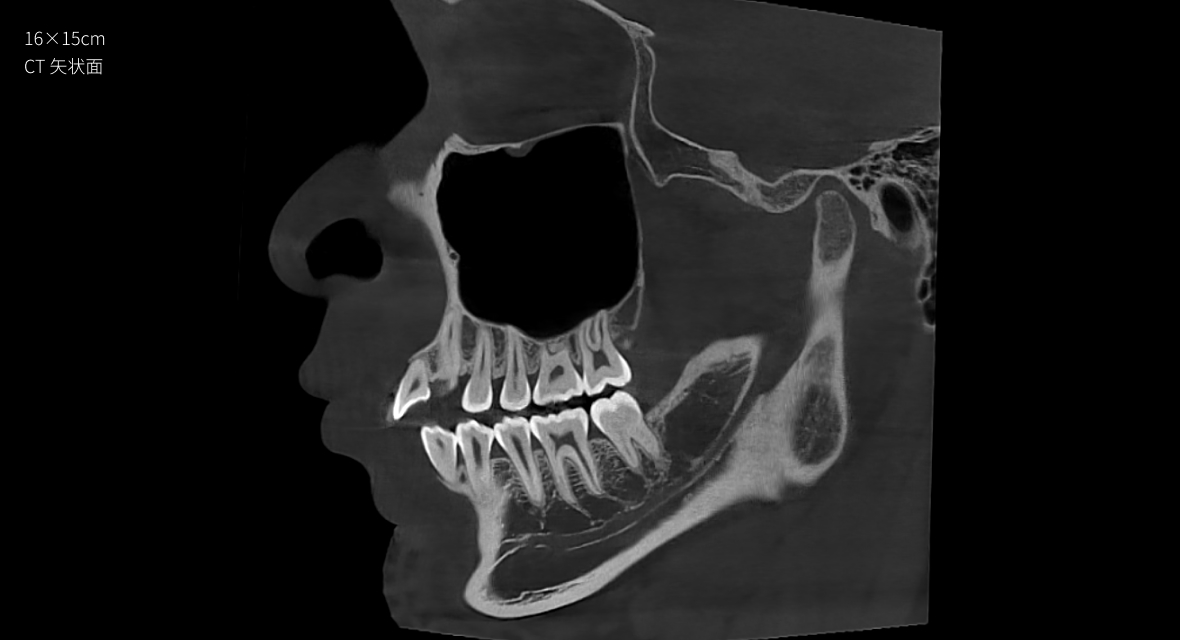 影像實(shí)力派