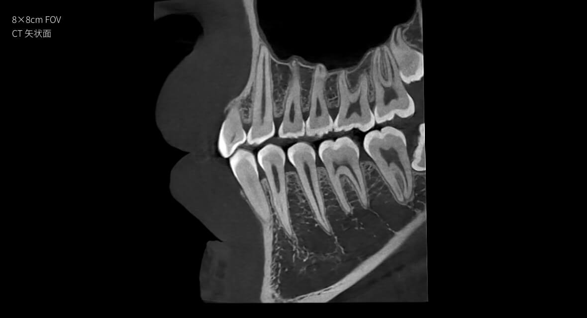 影像實(shí)力派