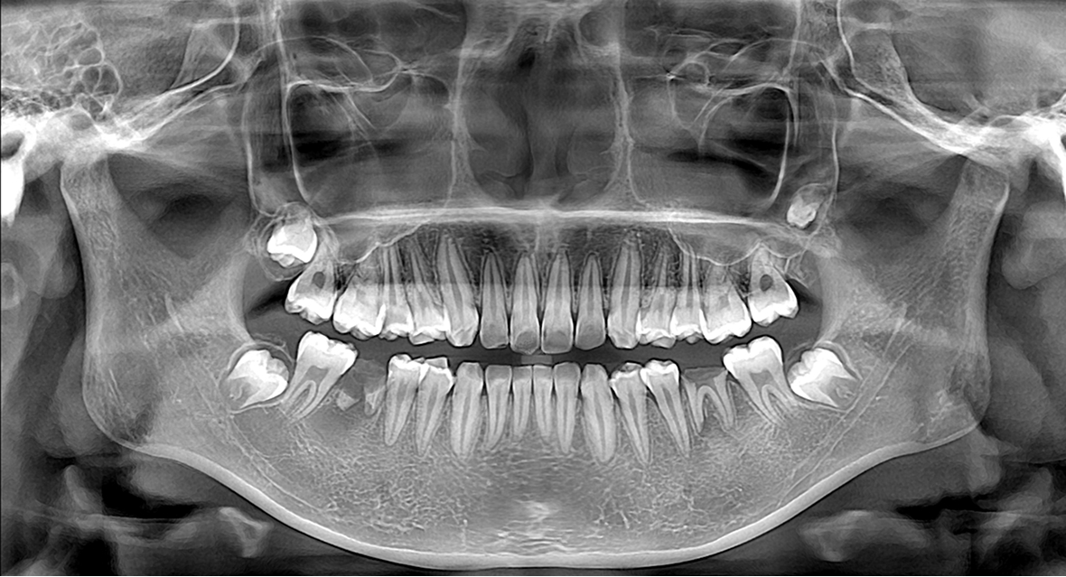 影像實(shí)力派