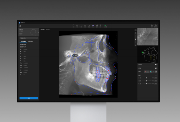 正畸測(cè)量軟件