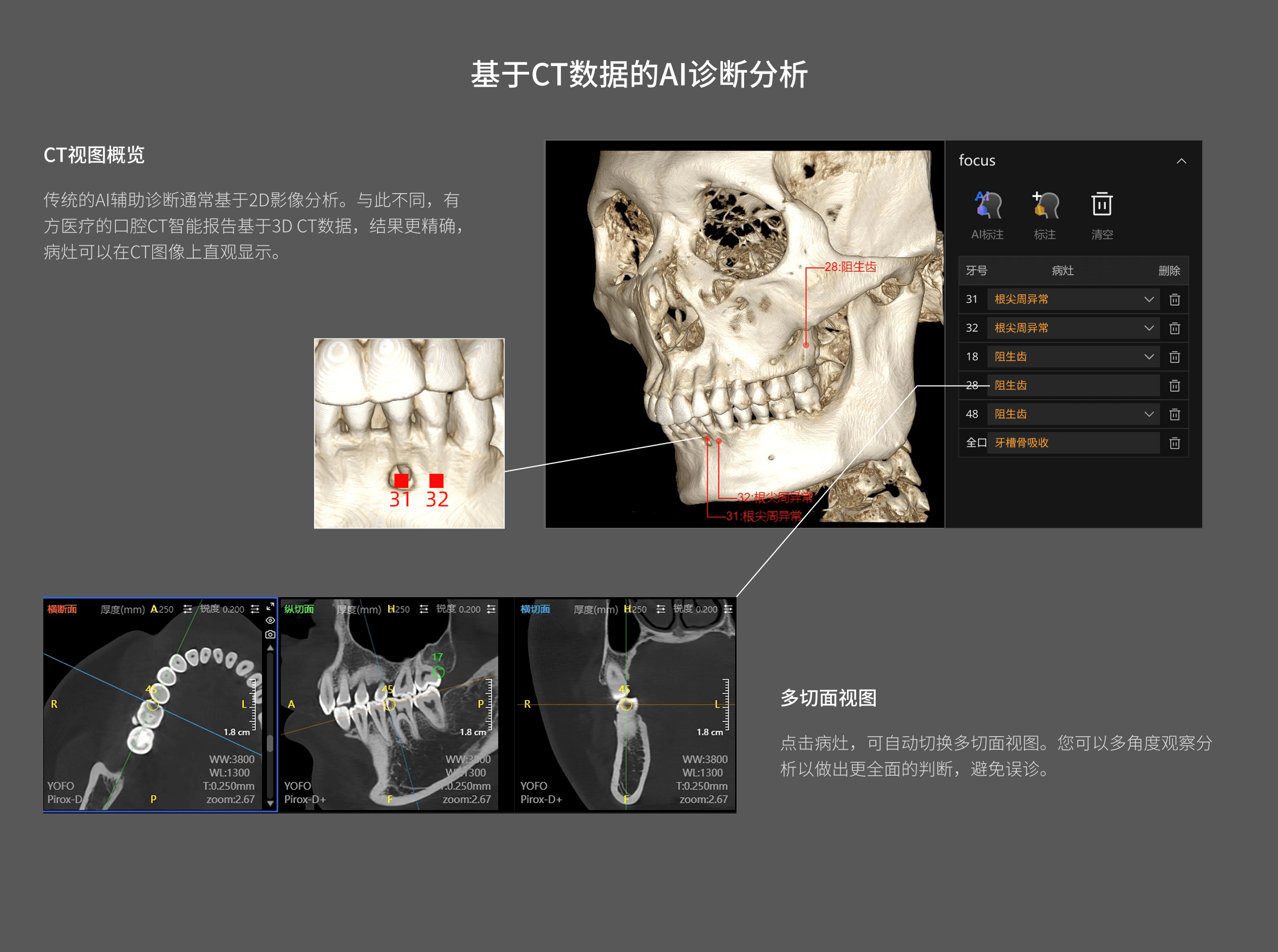 口腔CT智能報(bào)告