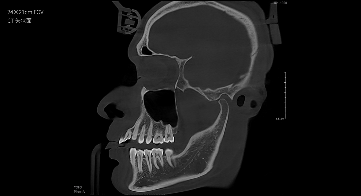 影像實(shí)力派