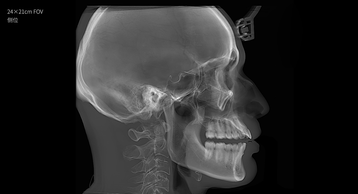 影像實(shí)力派