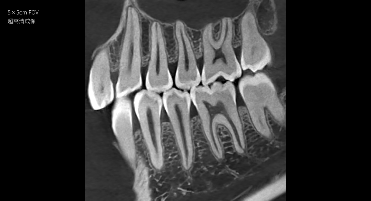 影像實(shí)力派
