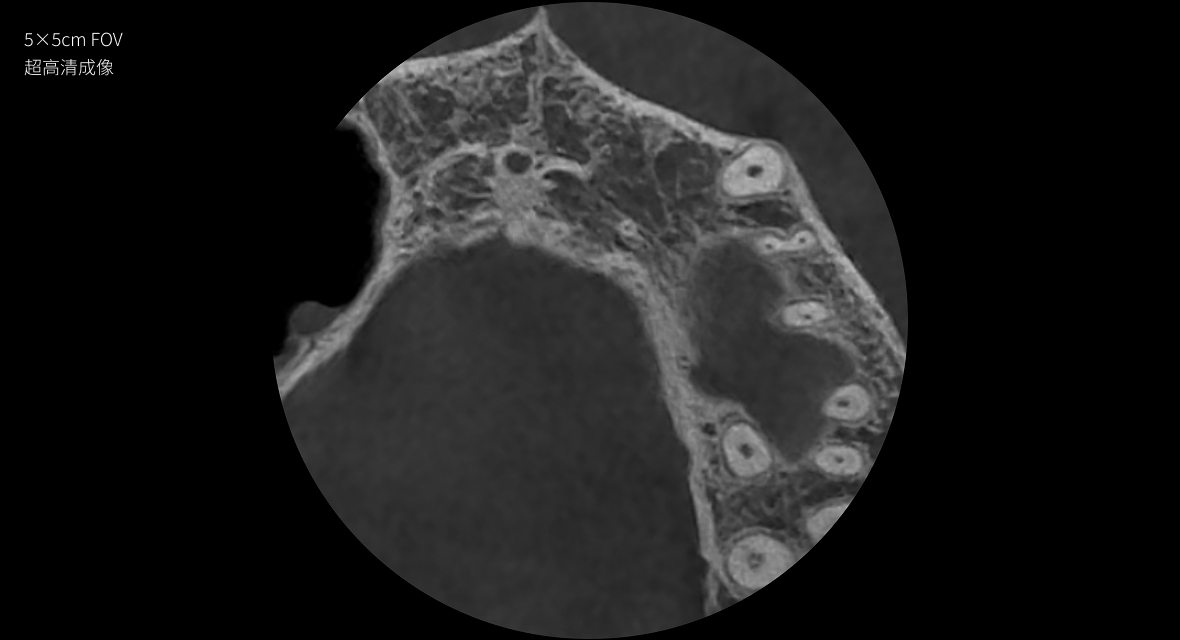 影像實(shí)力派