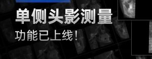 有方口腔CT單側(cè)頭影測(cè)量功能已上線！