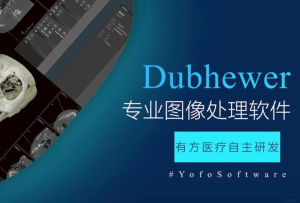 有方派CT影像中心——Dubhewer全新功能先睹為快！